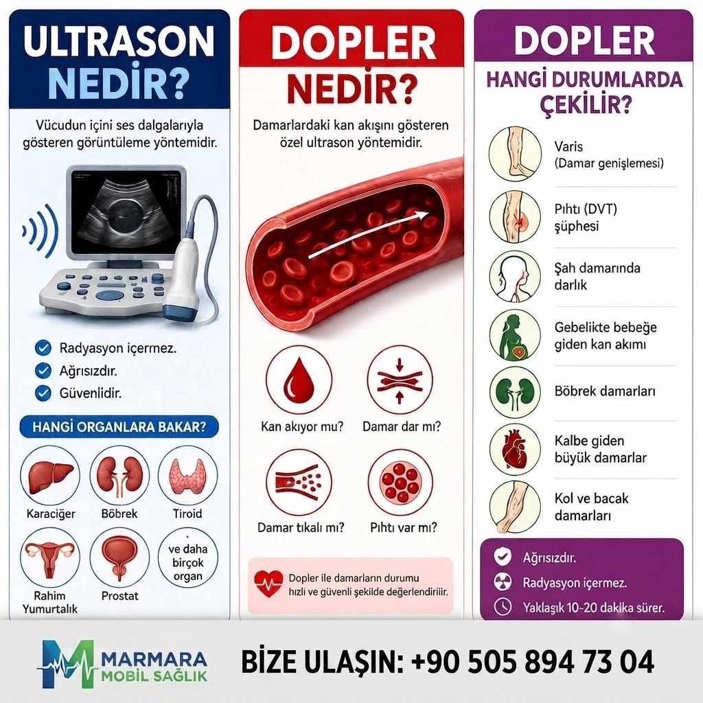Dopler Nedir