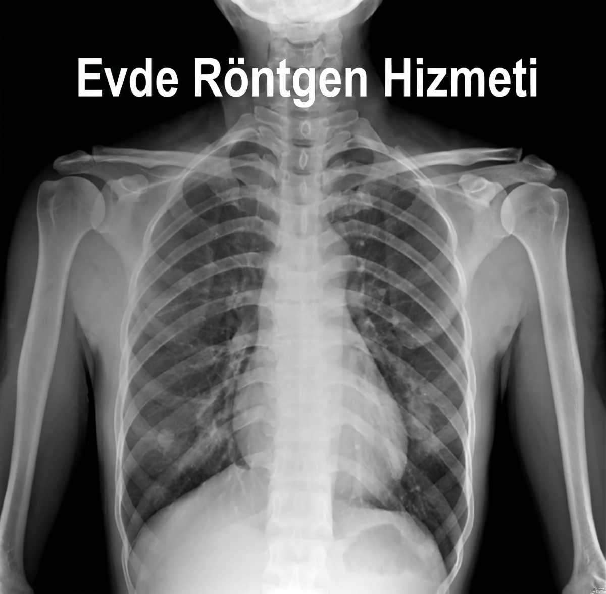 Evde Röntgen Çekimi